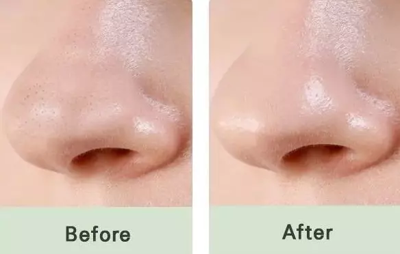 MIZON Pore Fresh Clear Nose Pack1_kimmi.jpg